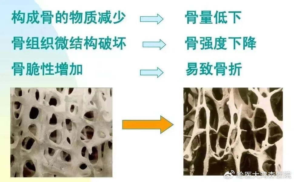 骨的质量分类，从基础到应用