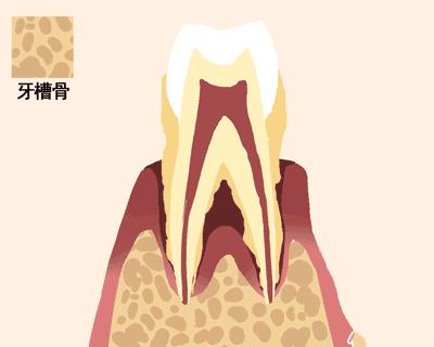 牙齿松动的原因及质量改善策略