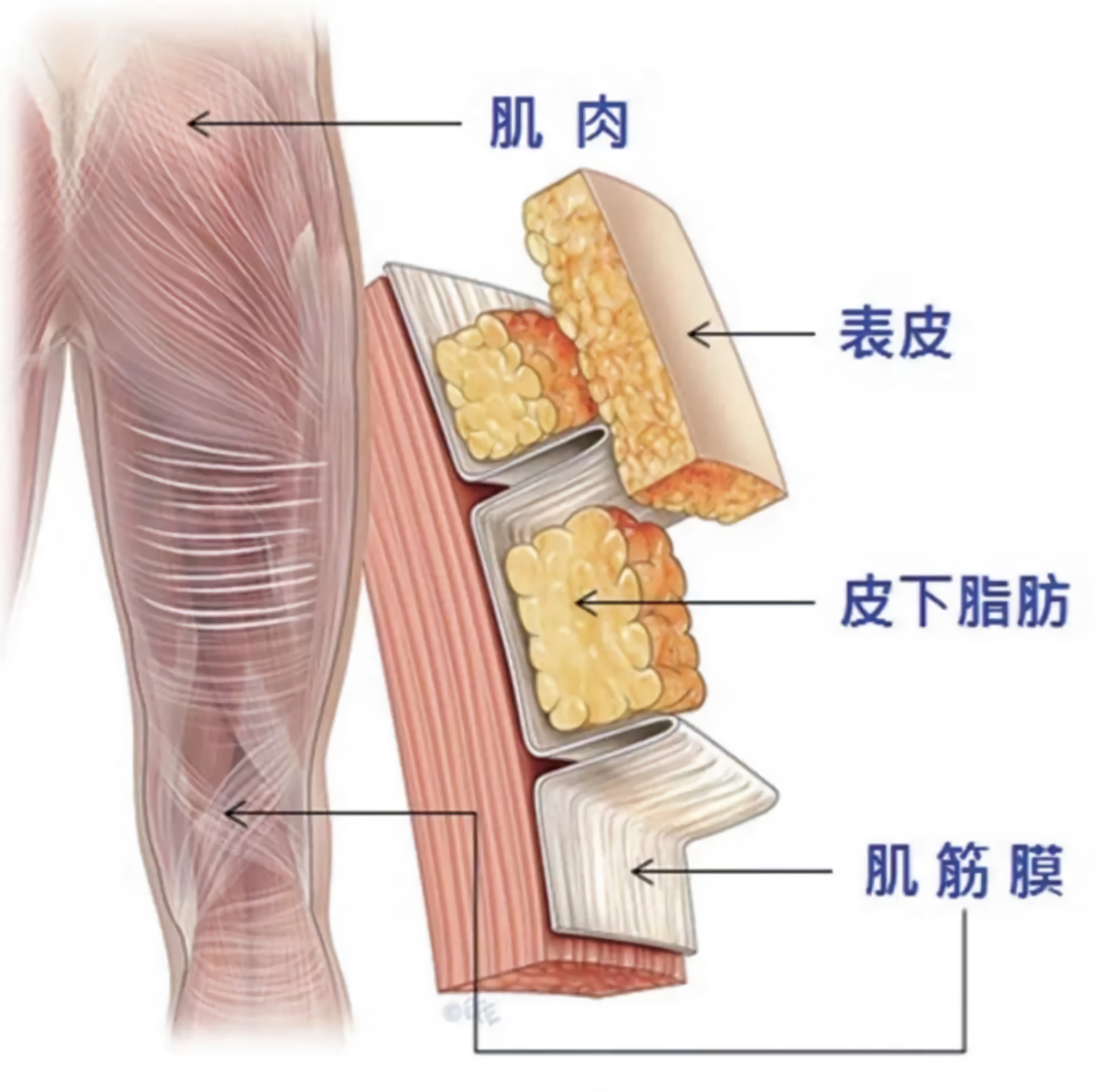 附睾炎的有效治疗策略与最佳治疗方案探讨