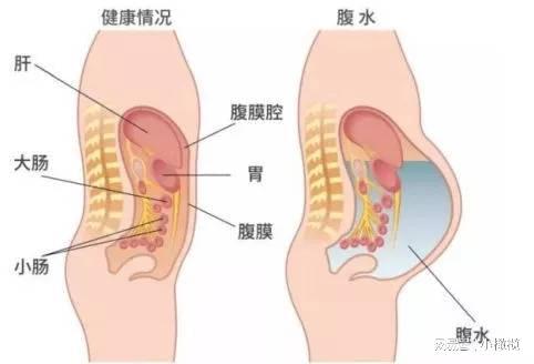 取卵比B超少，一种更为精细的生殖医学技术挑战与前景
