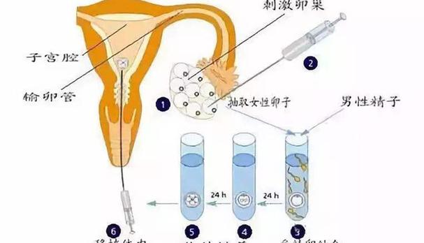 取卵针针头粗细，深度解析与综合理解