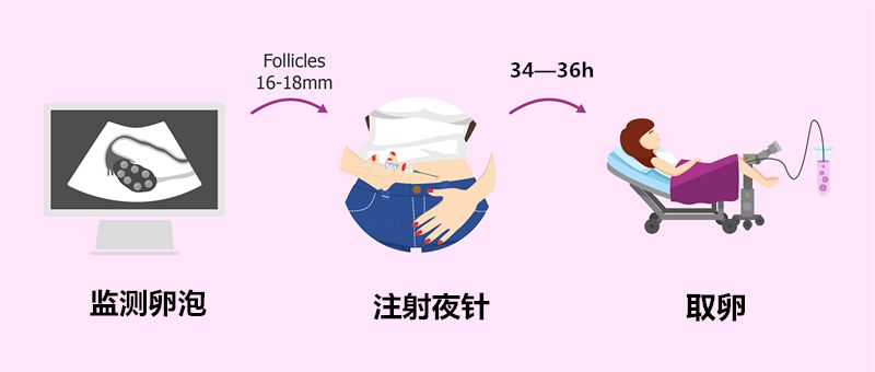 如何应对取卵后出现的腹水问题